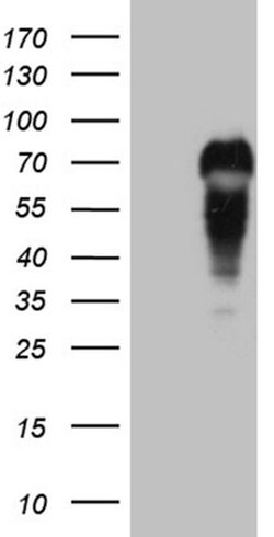 MYCN Monoclonal Antibody (OTI2A2), TrueMAB , OriGene 30 &mu;L; Unconjugated:Antibodies,