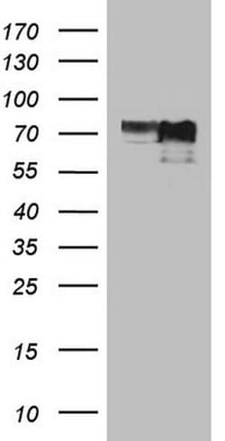MYCN Monoclonal Antibody (OTI1F1), TrueMAB , OriGene:Antibodies:Primary