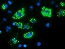 MYD88 Mouse anti-Human, Clone: OTI2B2, lyophilized, TrueMAB 100 &mu;g;