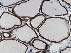 MYD88 Mouse anti-Human, Clone: OTI2B2, lyophilized, TrueMAB 100 &mu;g;