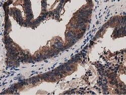 MYD88 Mouse anti-Human, Clone: OTI2B2, lyophilized, TrueMAB 100 &mu;g;