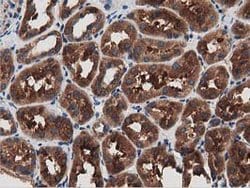 MYD88 Mouse anti-Human, Clone: OTI2B2, lyophilized, TrueMAB 100 &mu;g;