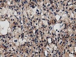 MYD88 Mouse anti-Human, Clone: OTI2B2, lyophilized, TrueMAB 100 &mu;g;