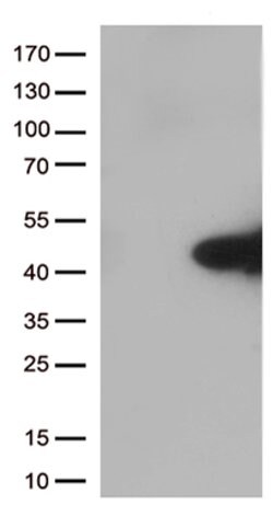 MYD88 Mouse anti-Human, Rat, Clone: OTI1B8, lyophilized, TrueMAB 100 &mu;g;
