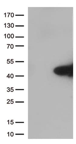 MYD88 Mouse anti-Human, Rat, Clone: OTI1B8, liquid, TrueMAB 100 &mu;L;