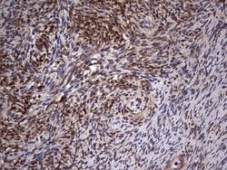 MYF5 Mouse anti-Human, Clone: OTI2G5, liquid, TrueMAB 100 &mu;L; Unconjugated:Antibodies,