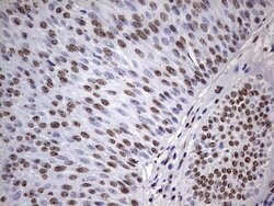 MYF5 Mouse anti-Human, Clone: OTI2G5, lyophilized, TrueMAB 100 &mu;g; Unconjugated:Antibodies,