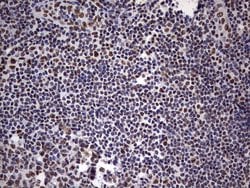 MYF5 Mouse anti-Human, Clone: OTI2G5, liquid, TrueMAB 100 &mu;L; Unconjugated:Antibodies,