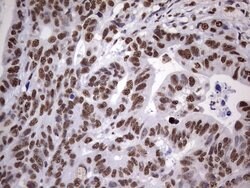 MYF5 Mouse anti-Human, Clone: OTI2G5, lyophilized, TrueMAB 100 &mu;g; Unconjugated:Antibodies,