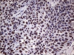 MYF5 Mouse anti-Human, Clone: OTI2G5, lyophilized, TrueMAB 100 &mu;g; Unconjugated:Antibodies,