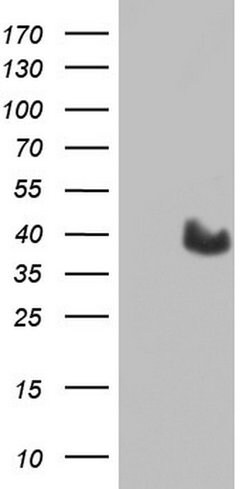 MYF5 Mouse anti-Human, Clone: OTI2G5, liquid, TrueMAB 100 &mu;L; Unconjugated:Antibodies,
