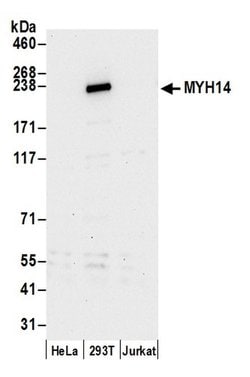 MYH14/Myosin-14 Polyclonal Antibody, Bethyl Laboratories 20 &mu;L; Unconjugated:Antibodies,