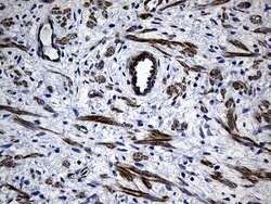 MYL1 Mouse anti-Human, Clone: OTI1H3, lyophilized, TrueMAB 100 &mu;g; Unconjugated:Antibodies,