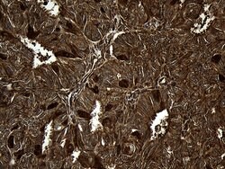 MYL1 Mouse anti-Human, Clone: OTI1D9, lyophilized, TrueMAB 100 &mu;g; Unconjugated:Antibodies,