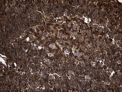 MYL1 Mouse anti-Human, Clone: OTI1D9, lyophilized, TrueMAB 100 &mu;g; Unconjugated:Antibodies,