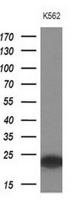 MYL4 Mouse anti-Human, Clone: OTI5A2, lyophilized, TrueMAB 100 &mu;g; Unconjugated:Antibodies,