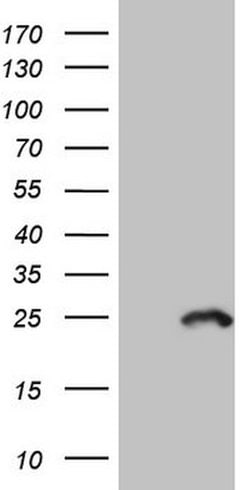 MYL4 Mouse anti-Human, Clone: OTI5A8, lyophilized, TrueMAB 100 &mu;g; Unconjugated:Antibodies,