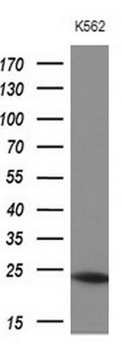 MYL4 Mouse anti-Human, Clone: OTI5A8, lyophilized, TrueMAB 100 &mu;g; Unconjugated:Antibodies,