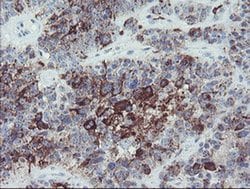 MYL7 Monoclonal Antibody (OTI7F2), TrueMAB , OriGene:Antibodies:Primary