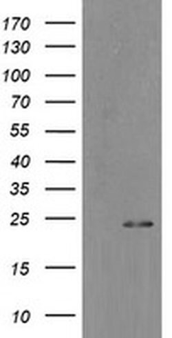 MYL7 Monoclonal Antibody (OTI7F2), TrueMAB , OriGene:Antibodies:Primary