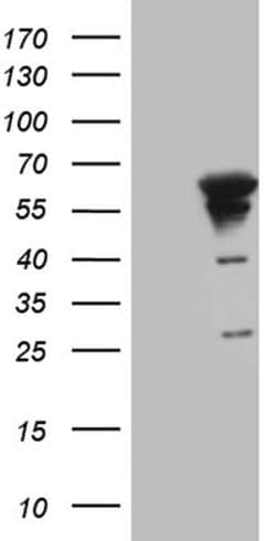 MYOT Monoclonal Antibody (OTI10A11), TrueMAB , OriGene 100 &mu;L; Unconjugated:Antibodies,