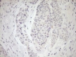 MYOZ1 Monoclonal Antibody (OTI4C2), TrueMAB , OriGene:Antibodies:Primary