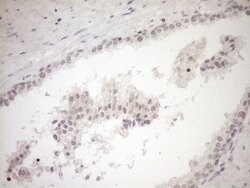 MYOZ1 Monoclonal Antibody (OTI4C2), TrueMAB , OriGene:Antibodies:Primary