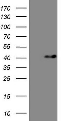 MYOZ1 Mouse anti-Human, Clone: OTI8A1, lyophilized, TrueMAB 100 &mu;g;