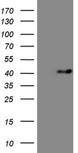 MYOZ1 Monoclonal Antibody (OTI8A1), TrueMAB , OriGene 30 &mu;L; Unconjugated:Antibodies,
