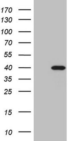 MYOZ1 Monoclonal Antibody (OTI3B5), TrueMAB , OriGene:Antibodies:Primary