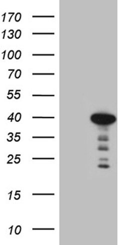 MYOZ1 Mouse anti-Human, Clone: OTI7E9, lyophilized, TrueMAB 100 &mu;g;
