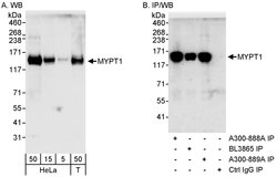 MYPT1 Rabbit anti-Human, Polyclonal, Bethyl Laboratories 100 &mu;L; Unconjugated:Antibodies,