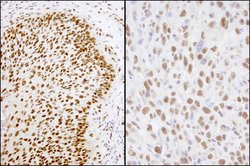 Matrin 3 Rabbit anti-Human, Mouse, Polyclonal, Bethyl Laboratories 10 &mu;L;