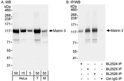 Matrin 3 Rabbit anti-Human, Mouse, Polyclonal, Bethyl Laboratories 100