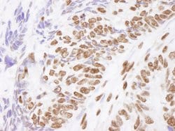 Matrin 3 Polyclonal Antibody, Bethyl Laboratories 10 &mu;l; Unlabeled:Antibodies,