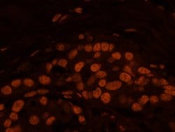 Matrin 3 Polyclonal Antibody, Bethyl Laboratories:Antibodies:Primary Antibodies