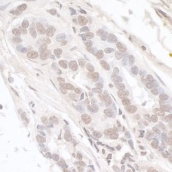 Menin Rabbit anti-Human, Mouse, Polyclonal, Bethyl Laboratories 100 &mu;L;