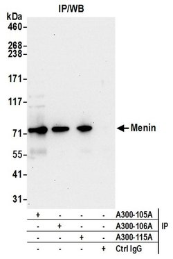 Menin Rabbit anti-Human, Mouse, Polyclonal, Bethyl Laboratories 100 &mu;L;