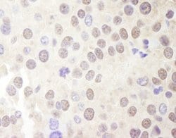 Menin Polyclonal Antibody, Bethyl Laboratories 100 &mu;L; Unconjugated:Antibodies,