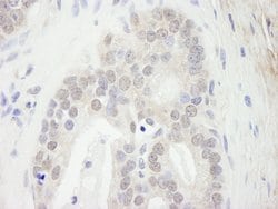 Menin Polyclonal Antibody, Bethyl Laboratories 100 &mu;L; Unconjugated:Antibodies,