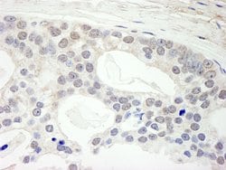 Menin Mouse anti-Human, Clone: 2G3G8, Bethyl Laboratories 20 &mu;L | Buy Online | Bethyl Laboratories, Inc | Fisher Scientific