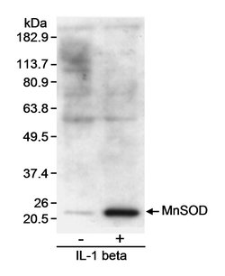 MnSOD Polyclonal Antibody, Bethyl Laboratories:Antibodies:Primary Antibodies