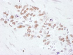 Mre11 Rabbit anti-Human, Polyclonal, Bethyl Laboratories 100 &mu;L; Unconjugated:Antibodies,