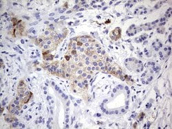 N4BP2L2 Monoclonal Antibody (OTI5C5), TrueMAB , OriGene 100 &mu;L; Unconjugated:Antibodies,