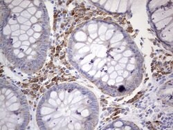 N4BP2L2 Monoclonal Antibody (OTI5C5), TrueMAB , OriGene 100 &mu;L; Unconjugated:Antibodies,