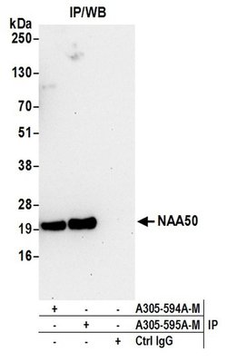 NAA50 Polyclonal Antibody, Bethyl Laboratories:Antibodies:Primary Antibodies
