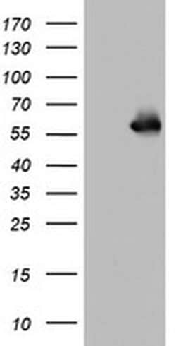 NAB1 Monoclonal Antibody (OTI1F1), TrueMAB , OriGene 100 &mu;L; Unconjugated:Antibodies,