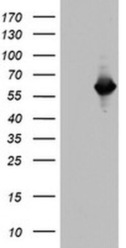 NAB1 Monoclonal Antibody (OTI4G10), TrueMAB , OriGene 100 &mu;L; Unconjugated:Antibodies,