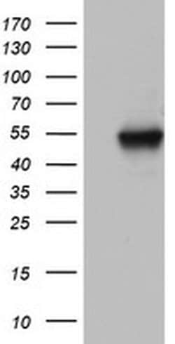 NAB1 Monoclonal Antibody (OTI5F2), TrueMAB , OriGene 100 &mu;L; Unconjugated:Antibodies,