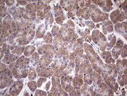 NAB2 Mouse anti-Human, Clone: OTI1E12, lyophilized, TrueMAB 100 &mu;g;
